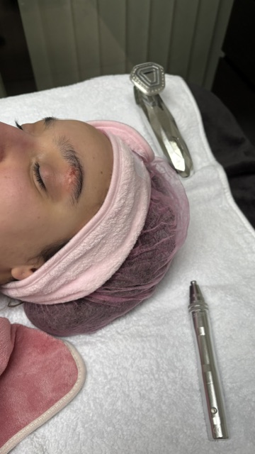 Voorbereiding van een Dermapen behandeling
