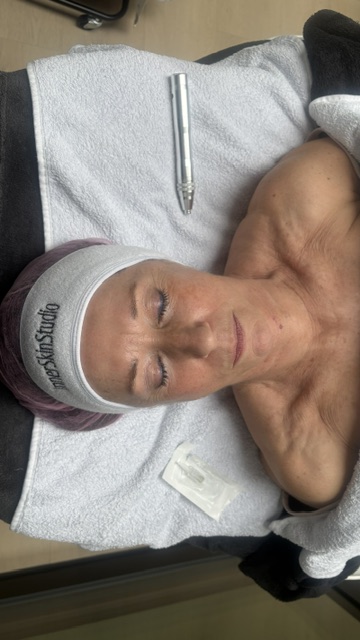 Gezichtsbehandeling afgestemd op de rijpere huid